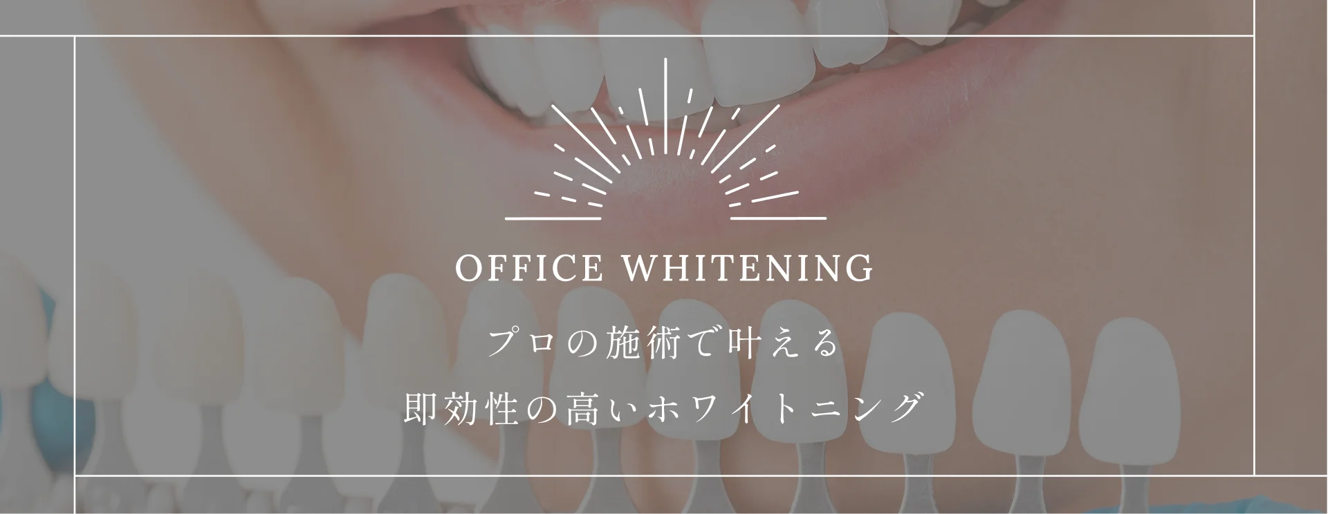 OFFICE WHITENING｜プロの施術で叶える即効性の高いホワイトニング